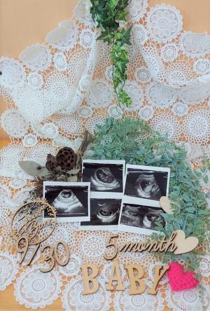 エコー写真のフォトブース